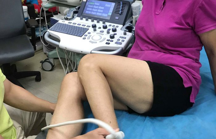 腳踝扭傷的丈母娘與貼紮