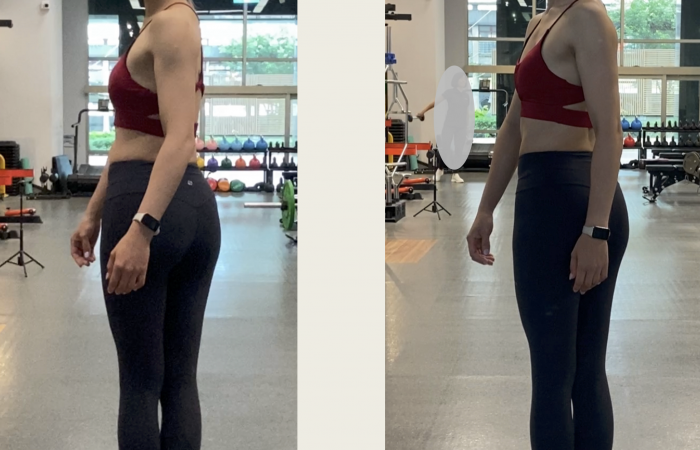 教學分享 旋轉卡卡不見得是脊椎的問題